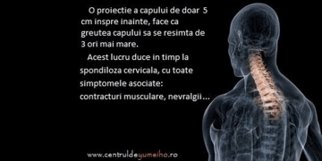 Señales de alarma en relación a la salud de la columna vertebral